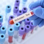Exame para Alzheimer custa até R$ 5 mil no Brasil