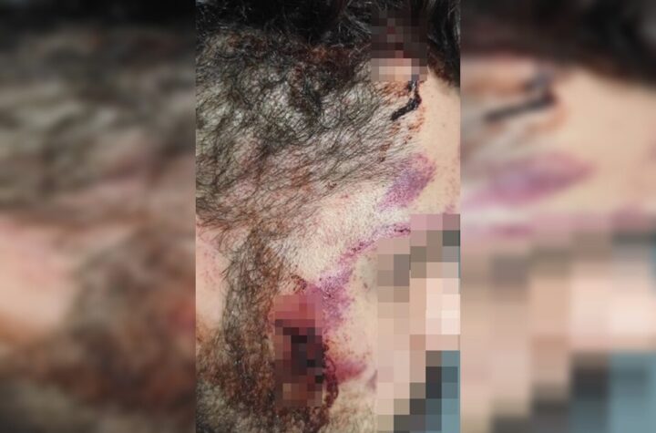 Motorista de app é espancado no DF após briga de trânsito